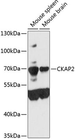 Western blot - CKAP2 antibody (A9706)