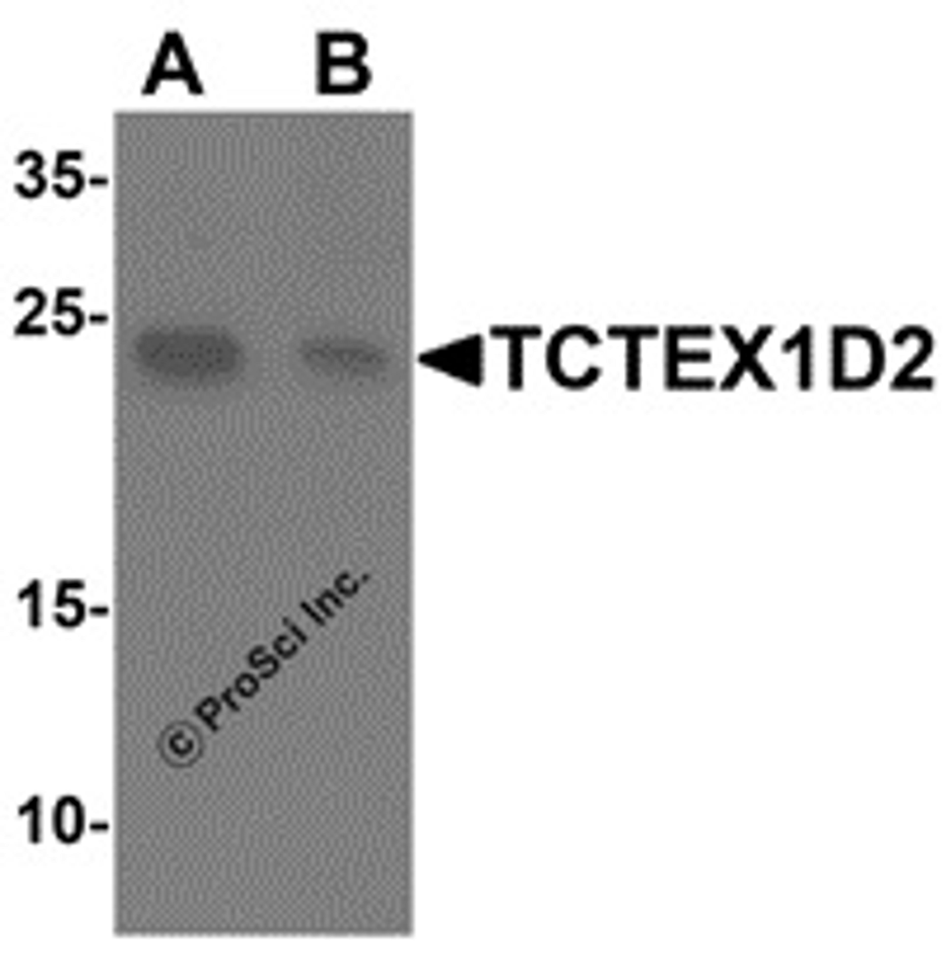 Western blot analysis of TCTEX1D2 in K562 cell lysate with TCTEX1D2 antibody at 1 μg/mL in (A) the absence and (B) the presence of blocking peptide.