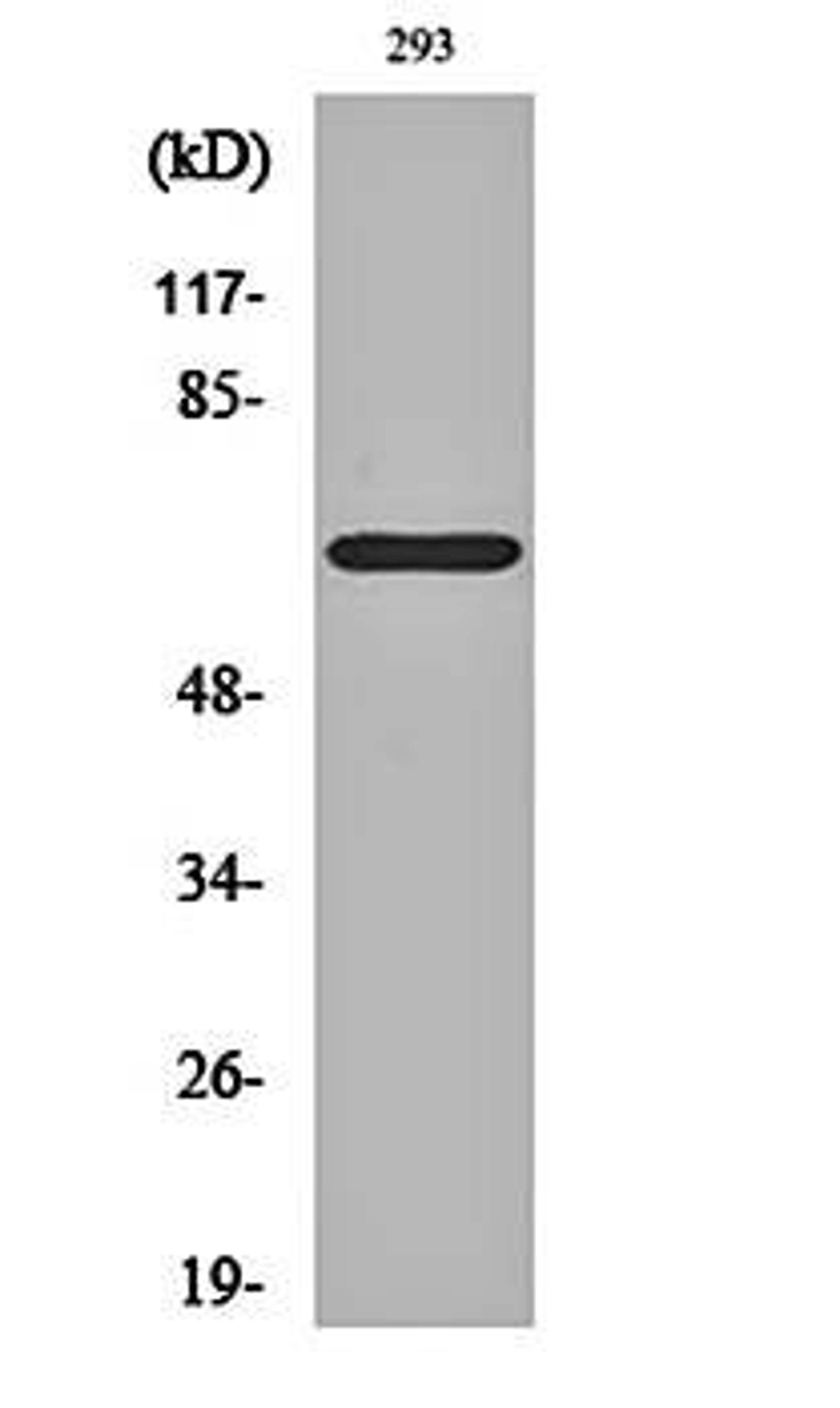 Western blot analysis of 293 cell lysates using ER alpha (phospho-S104) antibody