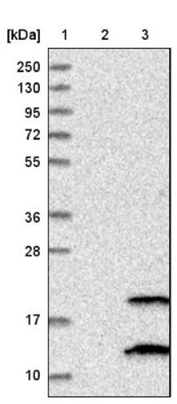 Western Blot: PIGP Antibody [NBP1-84294] - Lane 1: Marker [kDa] 250, 130, 95, 72, 55, 36, 28, 17, 10<br/>Lane 2: Negative control (vector only transfected HEK293T lysate)<br/>Lane 3: Over-expression lysate (Co-expressed with a C-terminal myc-DDK tag (~3.1 kDa) in mammalian HEK293T cells, LY407008)