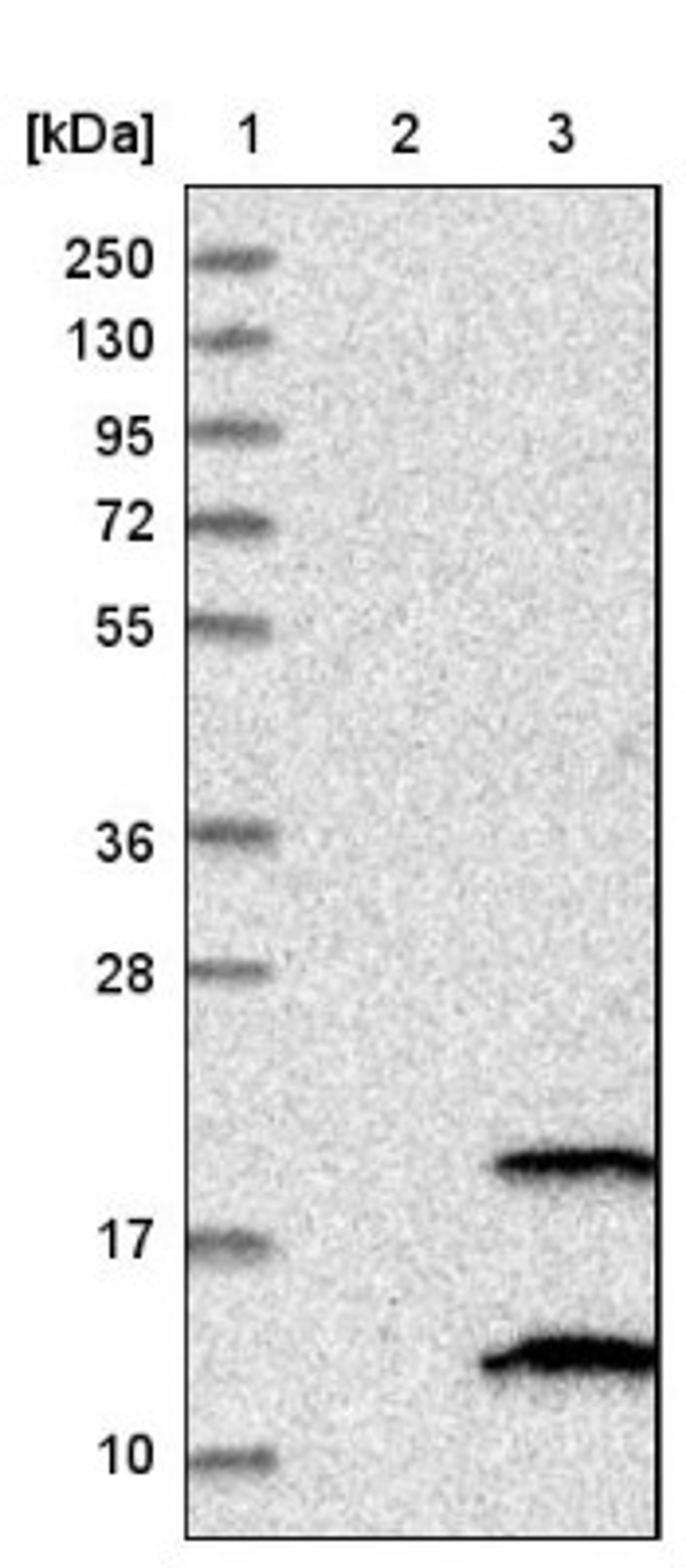 Western Blot: PIGP Antibody [NBP1-84294] - Lane 1: Marker [kDa] 250, 130, 95, 72, 55, 36, 28, 17, 10<br/>Lane 2: Negative control (vector only transfected HEK293T lysate)<br/>Lane 3: Over-expression lysate (Co-expressed with a C-terminal myc-DDK tag (~3.1 kDa) in mammalian HEK293T cells, LY407008)