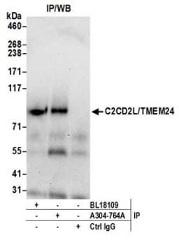 Detection of human C2CD2L/TMEM24 by western blot of immunoprecipitates.