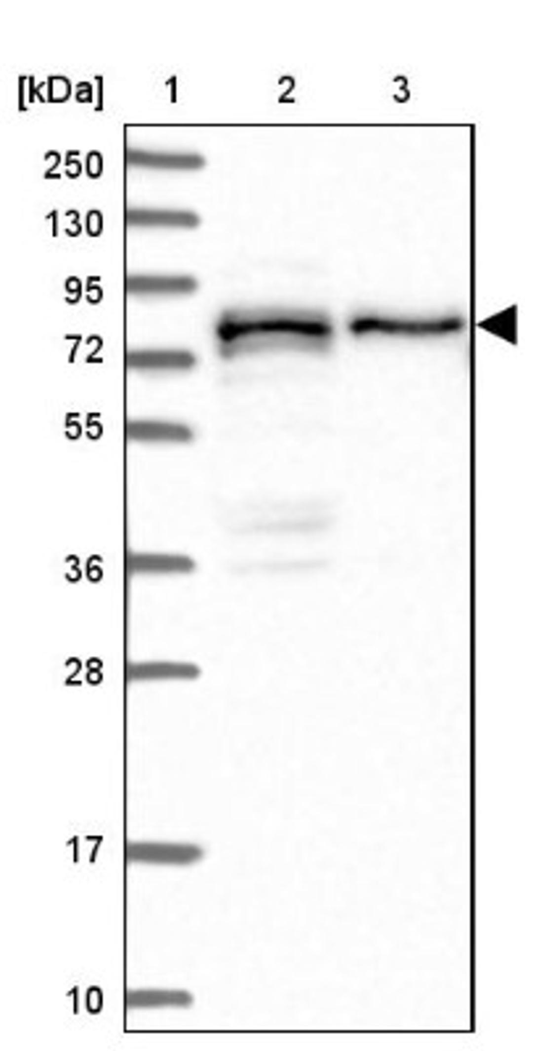 Western Blot: PEX5 Antibody [NBP1-87185] - Lane 1: Marker [kDa] 250, 130, 95, 72, 55, 36, 28, 17, 10<br/>Lane 2: Human cell line RT-4<br/>Lane 3: Human cell line U-251MG sp