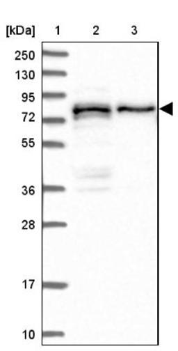 Western Blot: PEX5 Antibody [NBP1-87185] - Lane 1: Marker [kDa] 250, 130, 95, 72, 55, 36, 28, 17, 10<br/>Lane 2: Human cell line RT-4<br/>Lane 3: Human cell line U-251MG sp