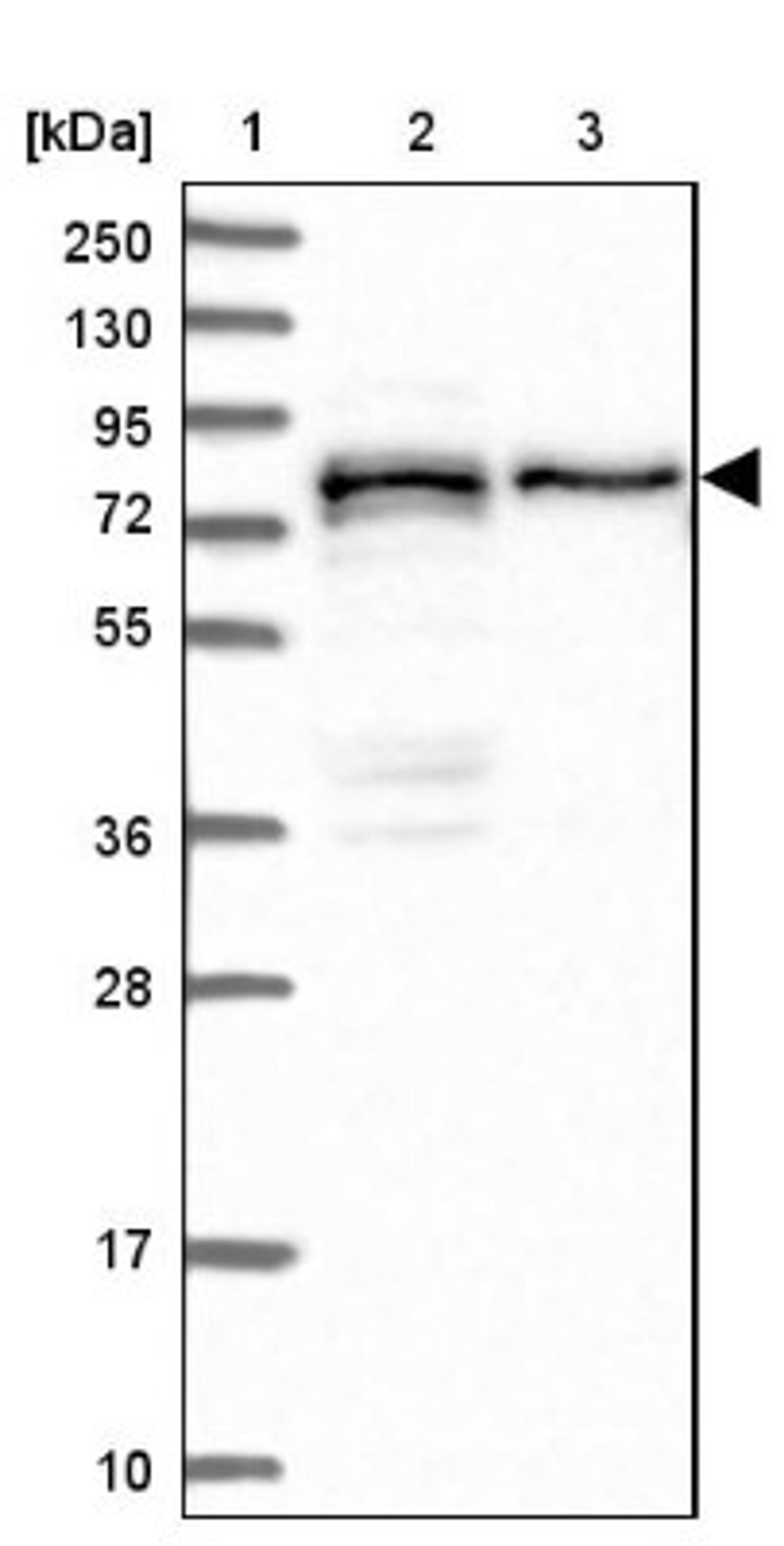 Western Blot: PEX5 Antibody [NBP1-87185] - Lane 1: Marker [kDa] 250, 130, 95, 72, 55, 36, 28, 17, 10<br/>Lane 2: Human cell line RT-4<br/>Lane 3: Human cell line U-251MG sp