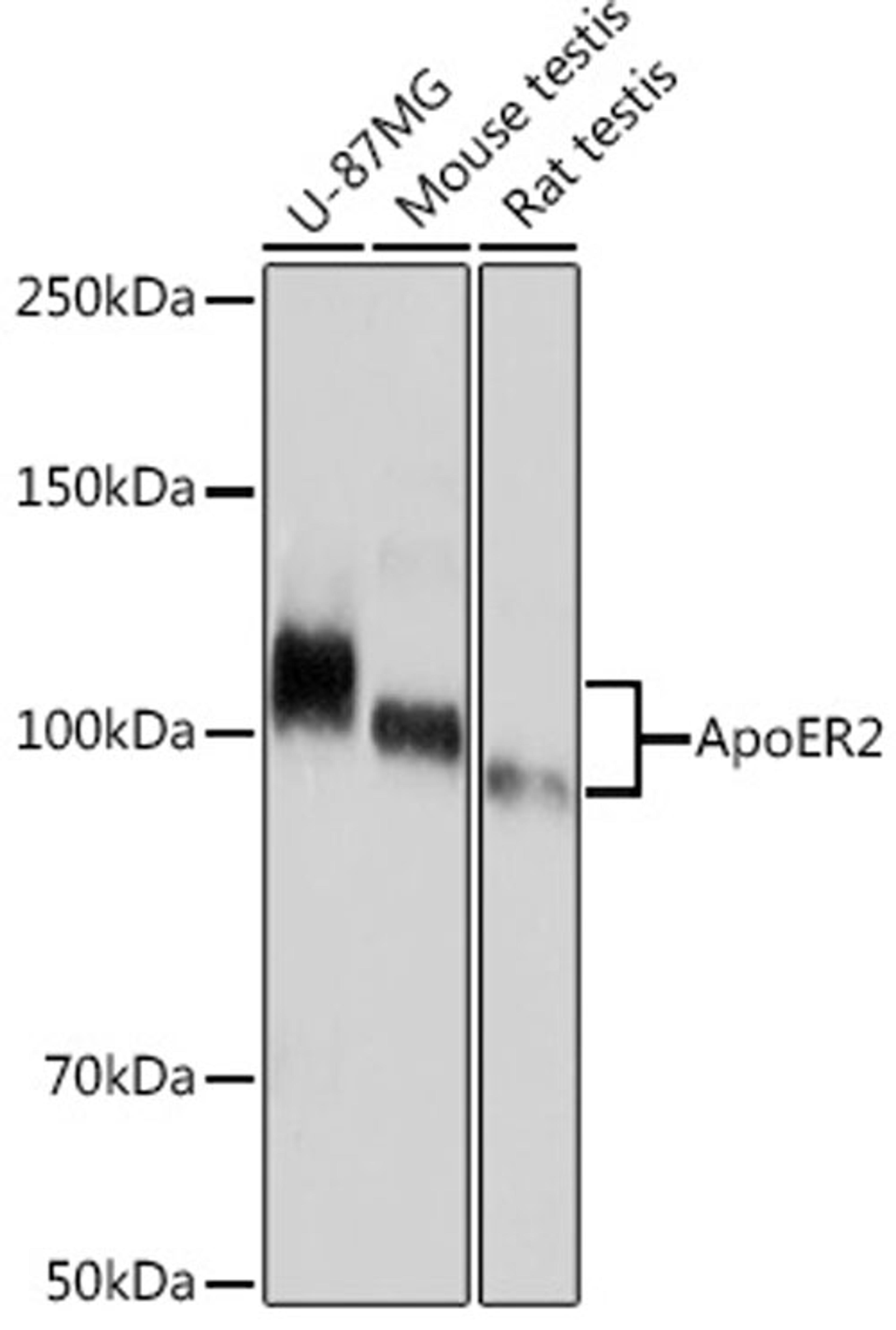 Western blot - ApoER2 Rabbit mAb (A9747)