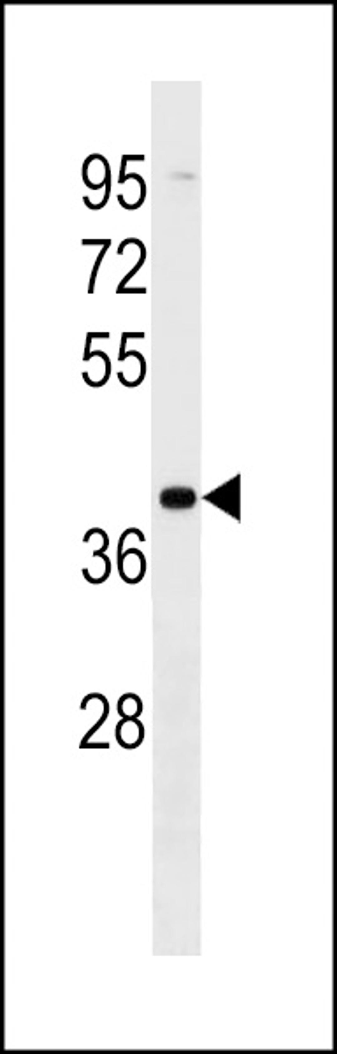 Western blot analysis in MDA-MB453 cell line lysates (35ug/lane).