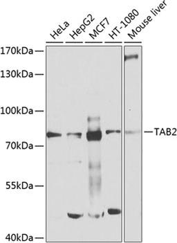 Western blot - TAB2 antibody (A9867)