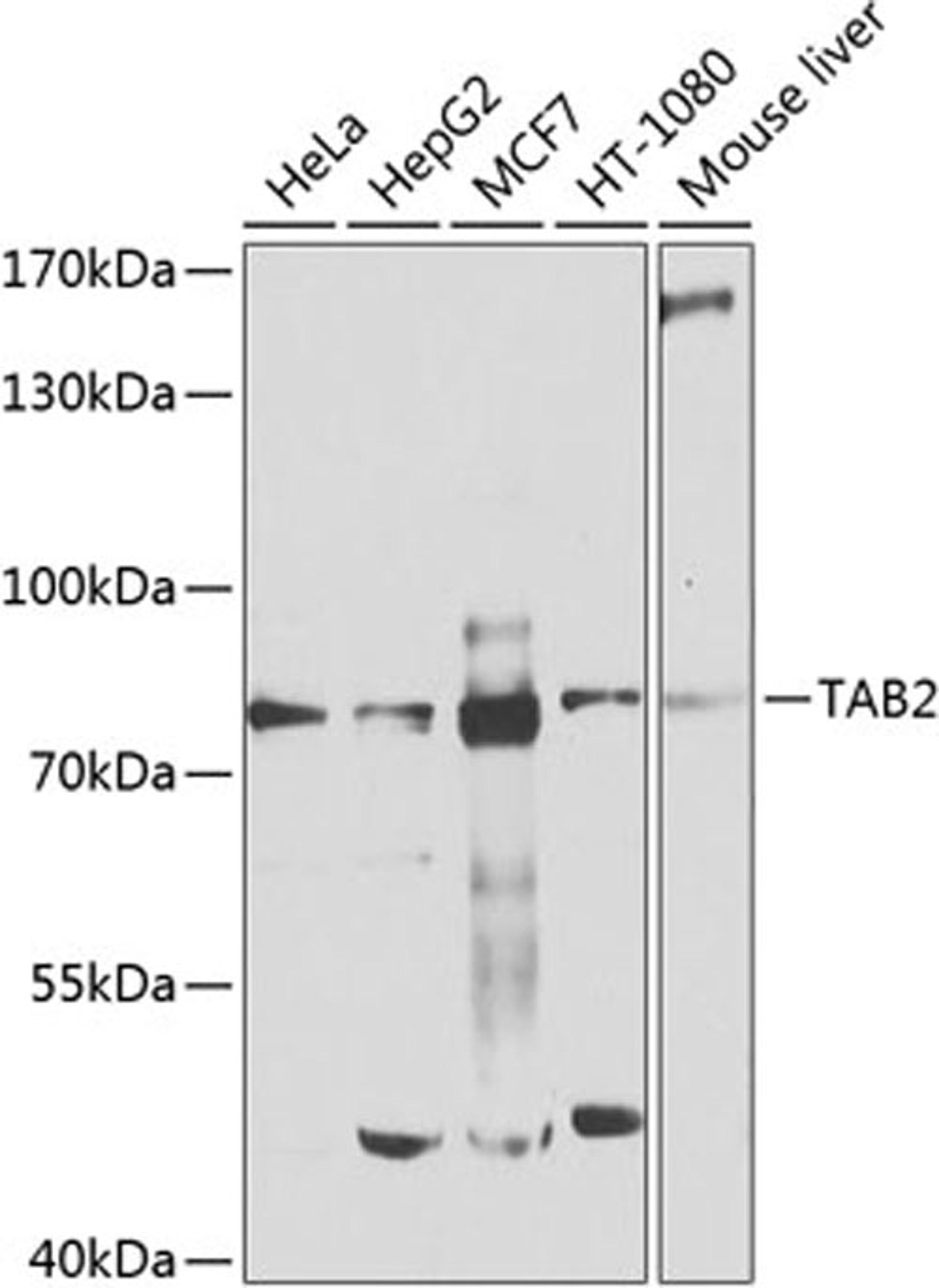 Western blot - TAB2 antibody (A9867)