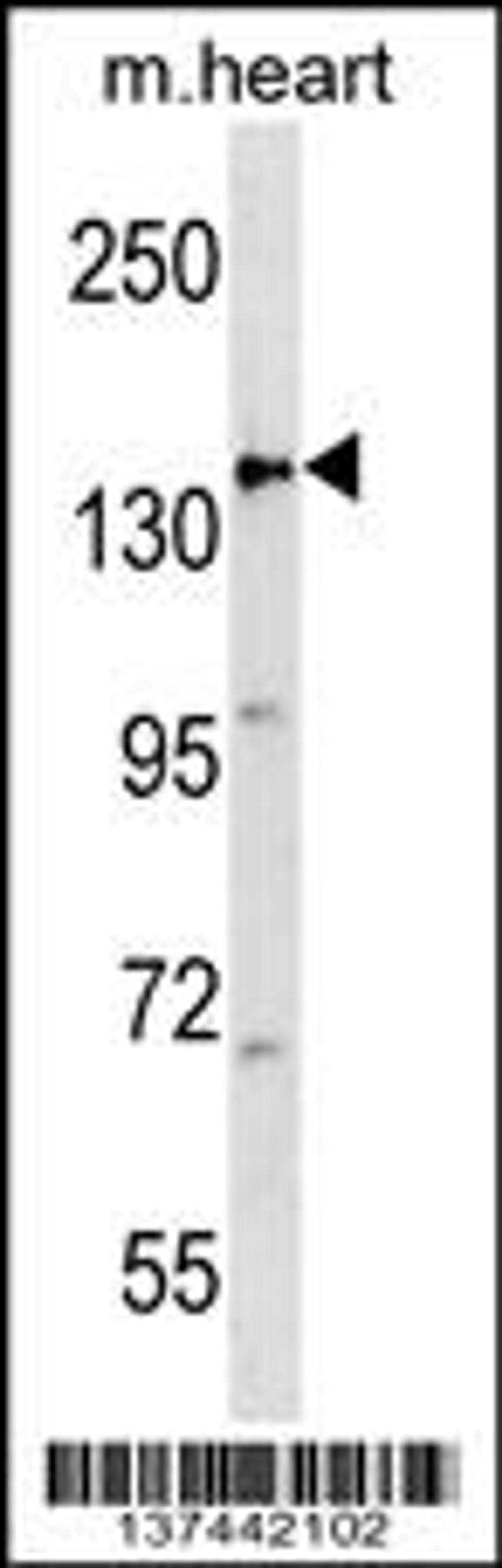 Western blot analysis in mouse heart tissue lysates (35ug/lane).