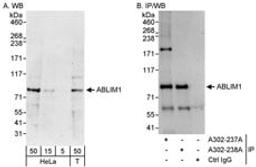 Detection of human ABLIM1 by western blot and immunoprecipitation.