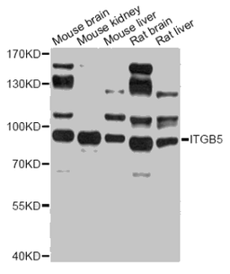 Western blot analysis of extracts of various cell lines, using ITGB5 antibody