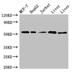 Western Blot. Positive WB detected in: MCF-7 whole cell lysate, HepG2 whole cell lysate, Jurkat whole cell ltysate, Mouse liver tissue, Rat liver tissue. All lanes: KAT8 antibody at 3ug/ml. Secondary. Goat polyclonal to rabbit IgG at 1/50000 dilution. Predicted band size: 53, 54 kDa. Observed band size: 53 kDa. 