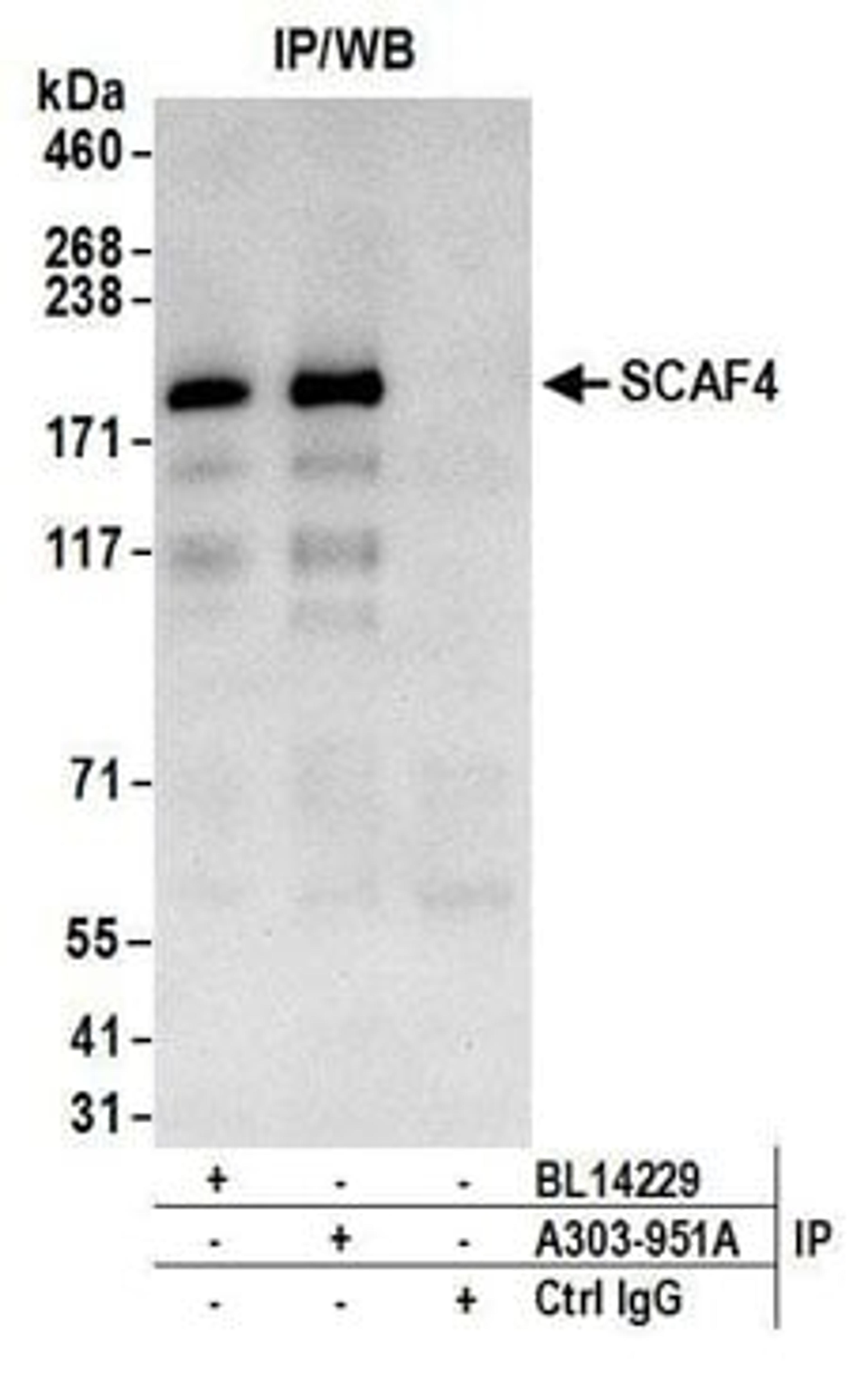 Detection of human SCAF4 by western blot of immunoprecipitates.