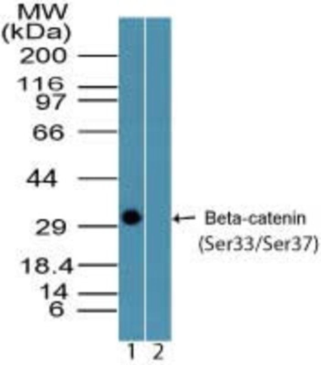 Western Blot: beta Catenin [p Ser33, p Ser37] Antibody [NBP2-24456] - Analysis of Beta-catenin (Ser33/Ser37) in recombinant fusion protein containing 1) phosphorylated serine residues at positions 33 and 37 and 2) unphosphorylated serine residues at positions 33 and 37, using beta catenin phospho antibody at 0.25 ug/ml.  Goat anti-rabbit Ig HRP secondary antibody and PicoTect ECL substrate solution were used for this test.