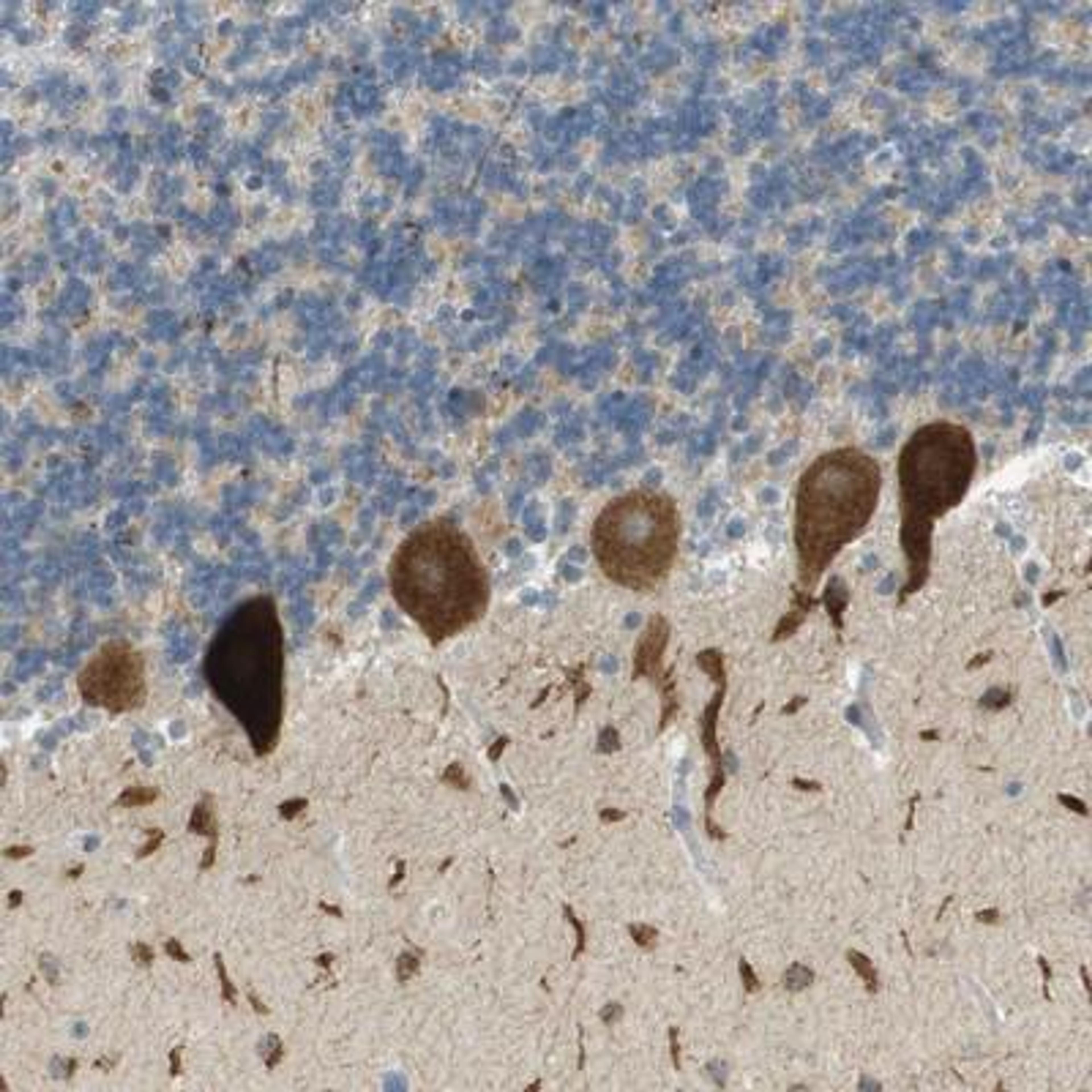 Immunohistochemistry: PLBD2 Antibody [NBP1-90681] - Staining of human cerebellum shows strong cytoplasmic positivity in Purkinje cells.