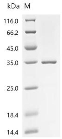 (Tris-Glycine gel) Discontinuous SDS-PAGE (reduced) with 5% enrichment gel and 15% separation gel.