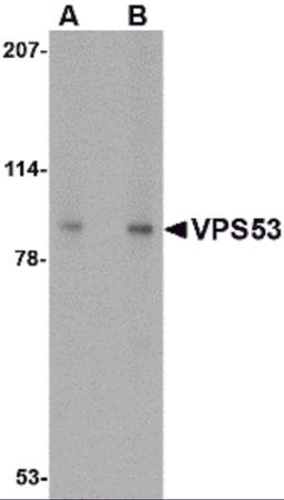 Western blot analysis of VPS53 in 293 cell lysate with VPS53 antibody at (A) 0.5 and (B) 1 &#956;g/mL.