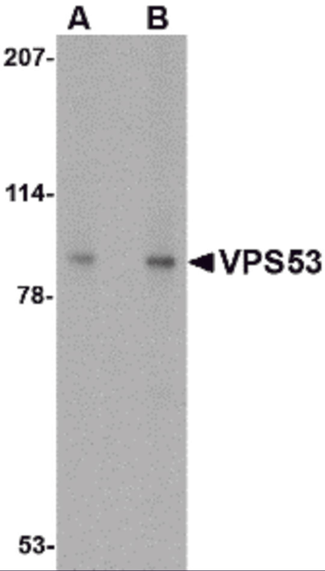 Western blot analysis of VPS53 in 293 cell lysate with VPS53 antibody at (A) 0.5 and (B) 1 μg/mL.