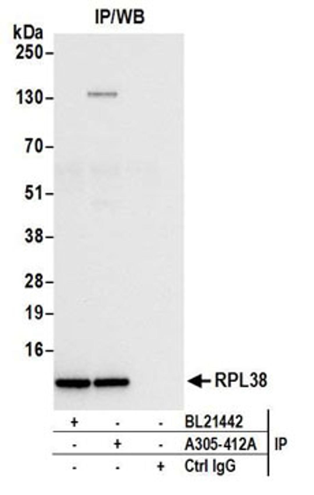 Detection of human RPL38 by western blot of immunoprecipitates.