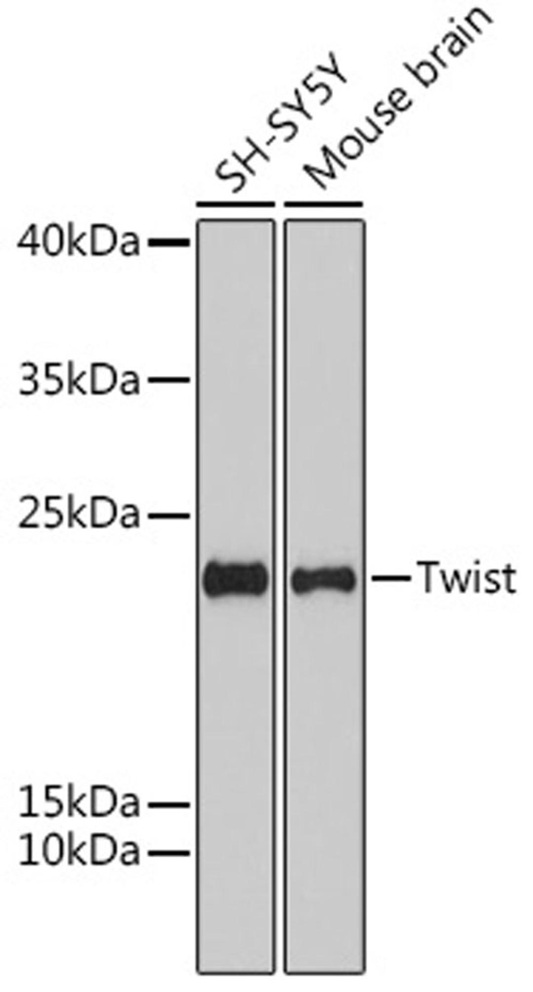 Western blot - Twist antibody (A15596)