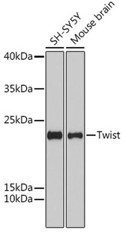 Western blot - Twist antibody (A15596)