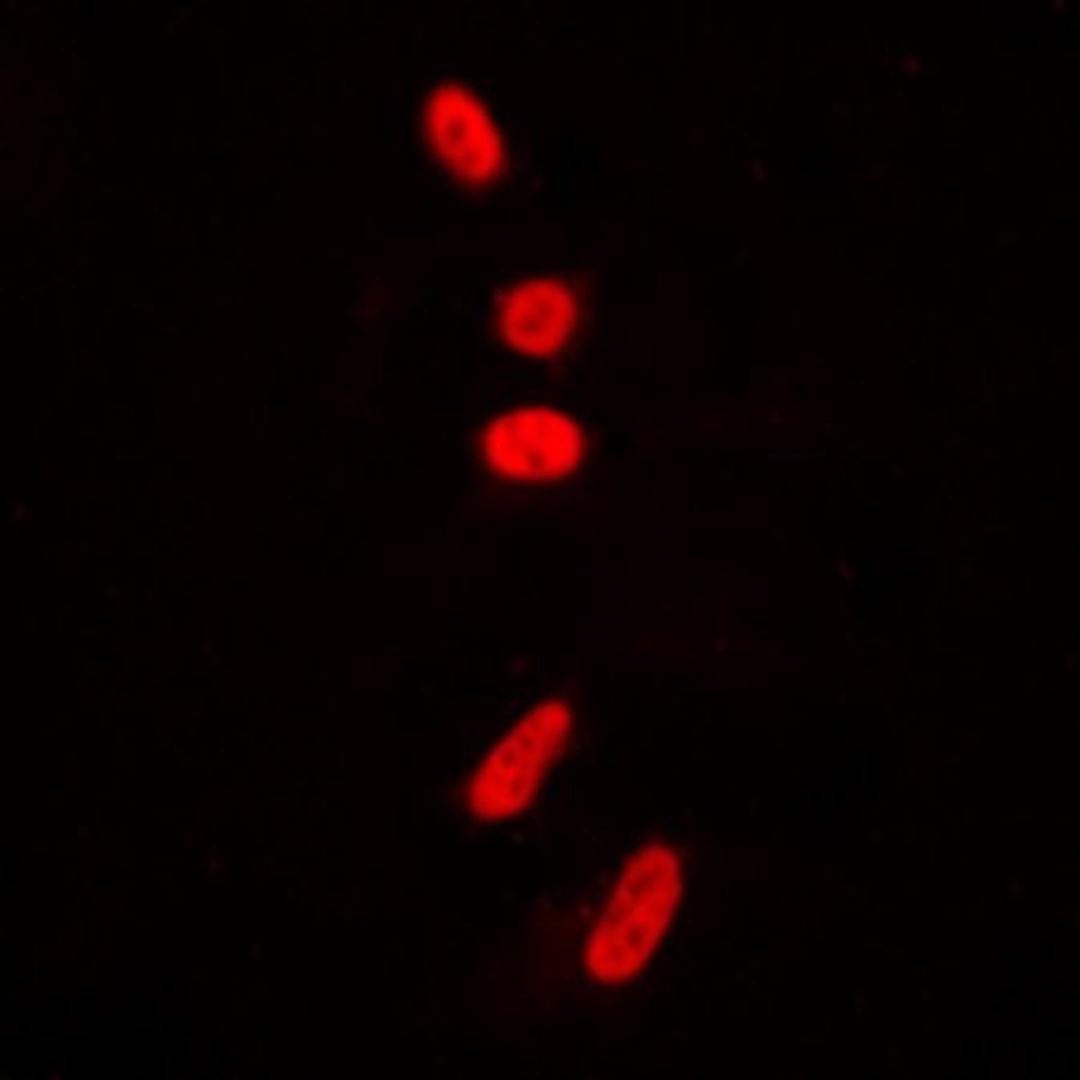 Immunofluorescense analysis of HeLa cells using p53 (AcK381) antibody