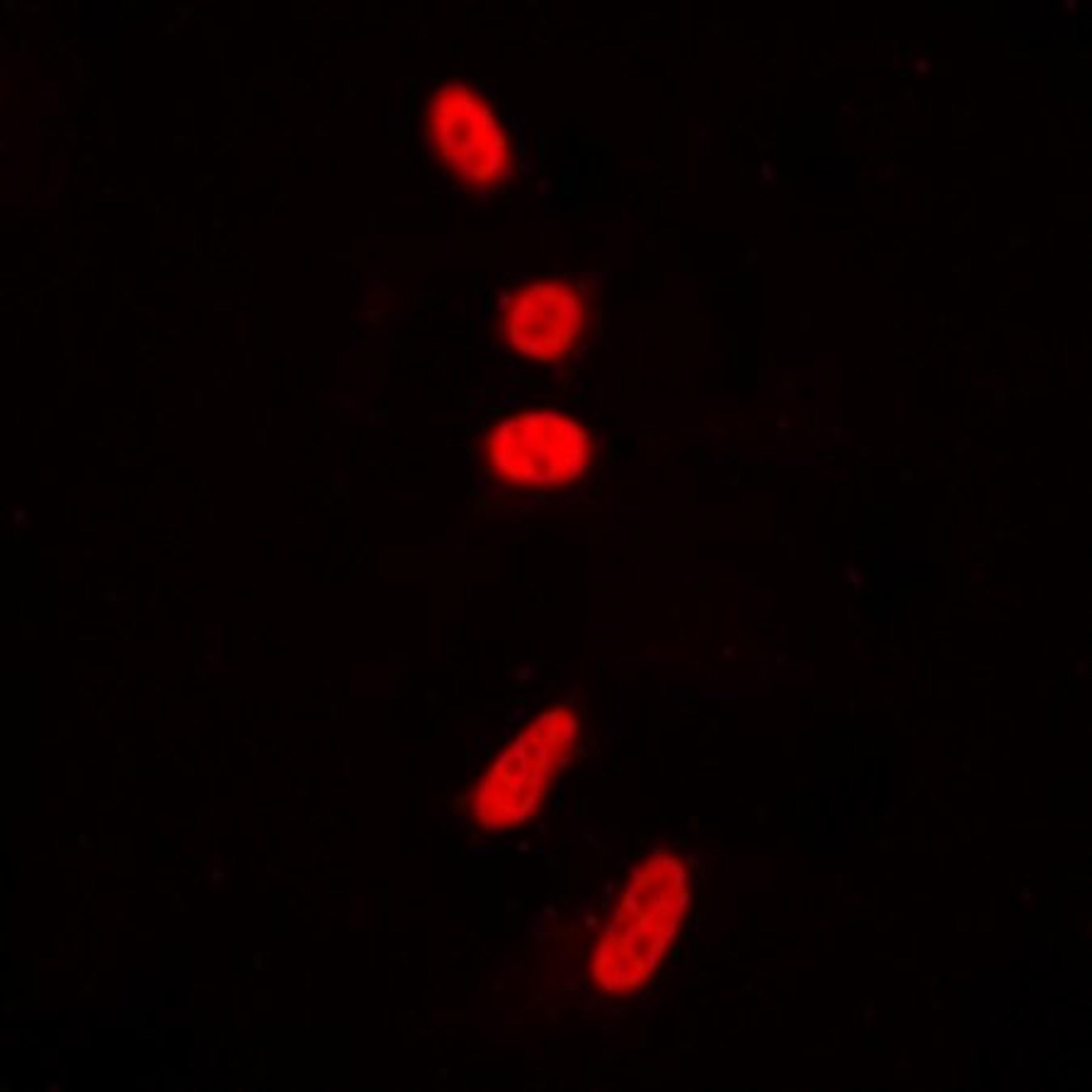 Immunofluorescense analysis of HeLa cells using p53 (AcK381) antibody