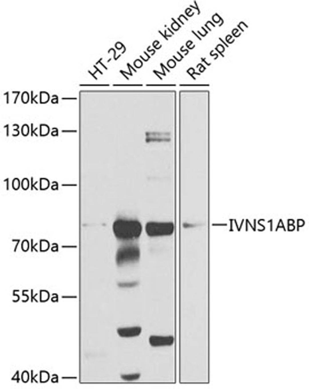 Western blot - IVNS1ABP antibody (A4442)