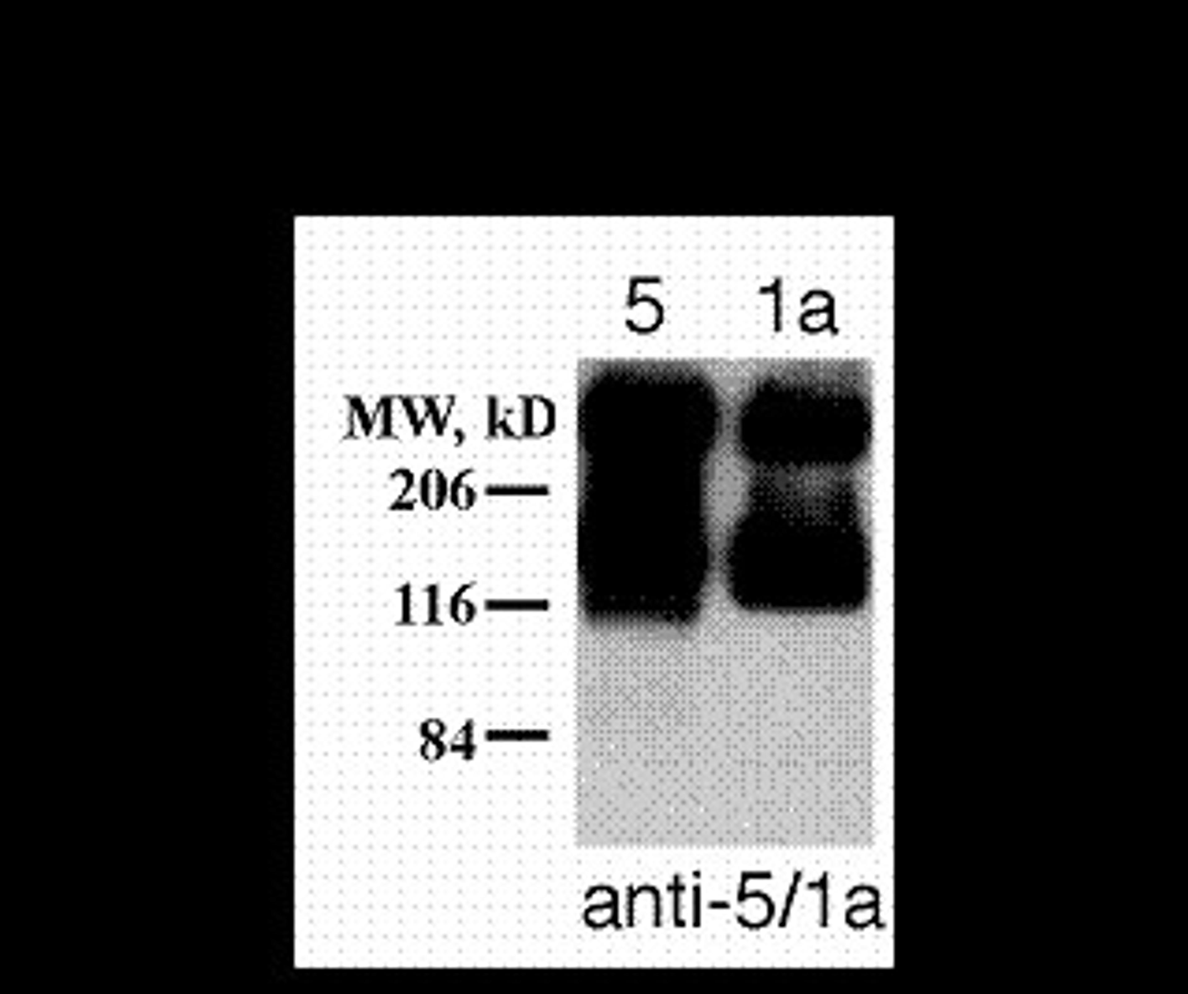 Metabotropic Glutamate Receptor 5/1a Antibody