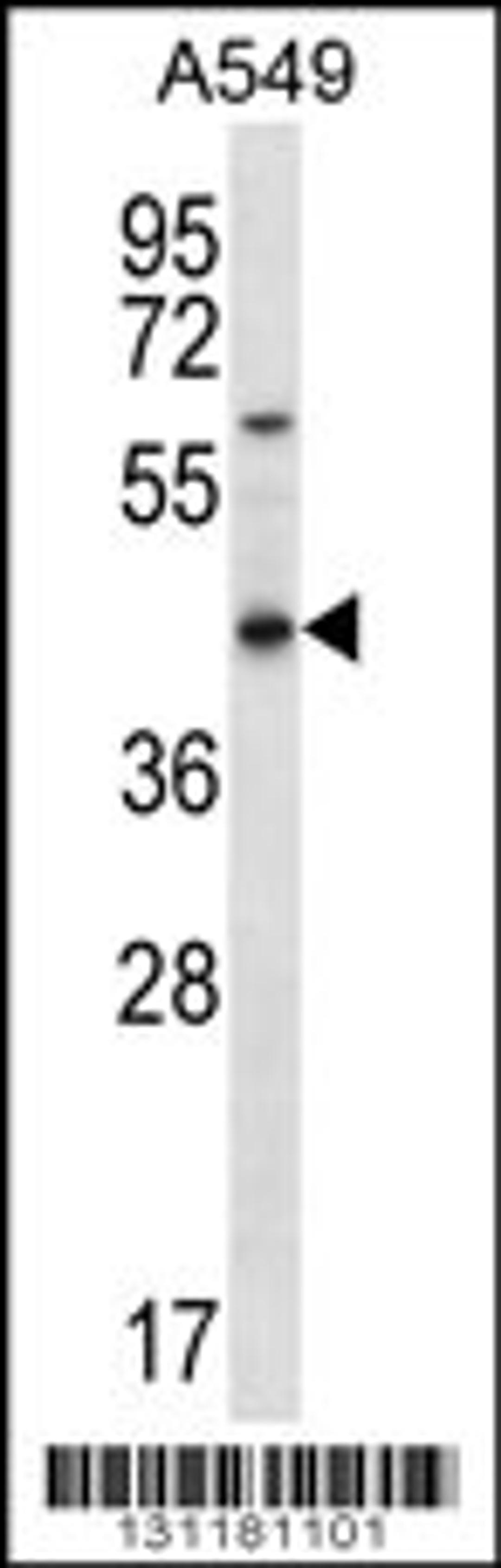 Western blot analysis in A549 cell line lysates (35ug/lane).