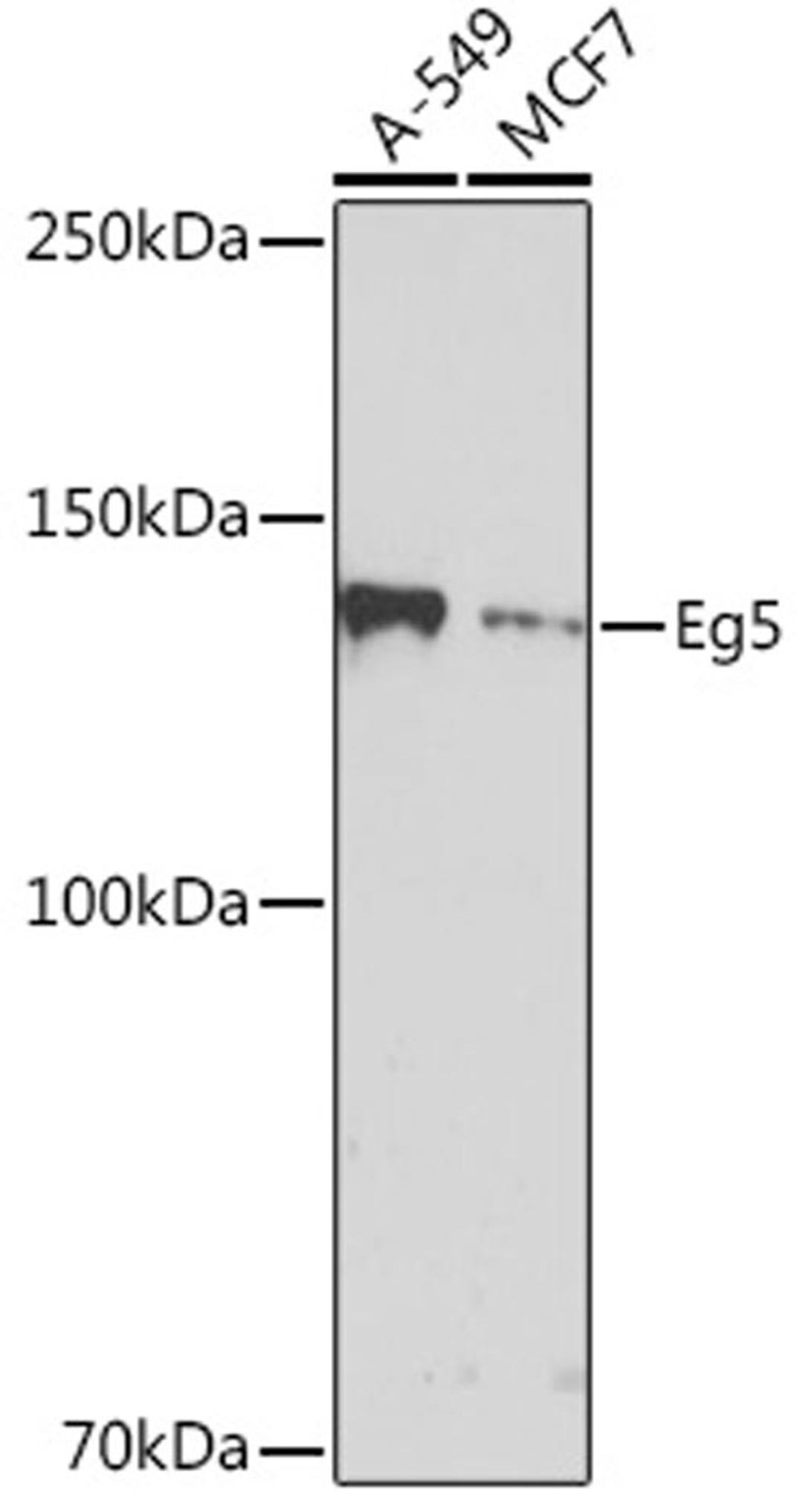 Western blot - Eg5 Rabbit mAb (A4659)