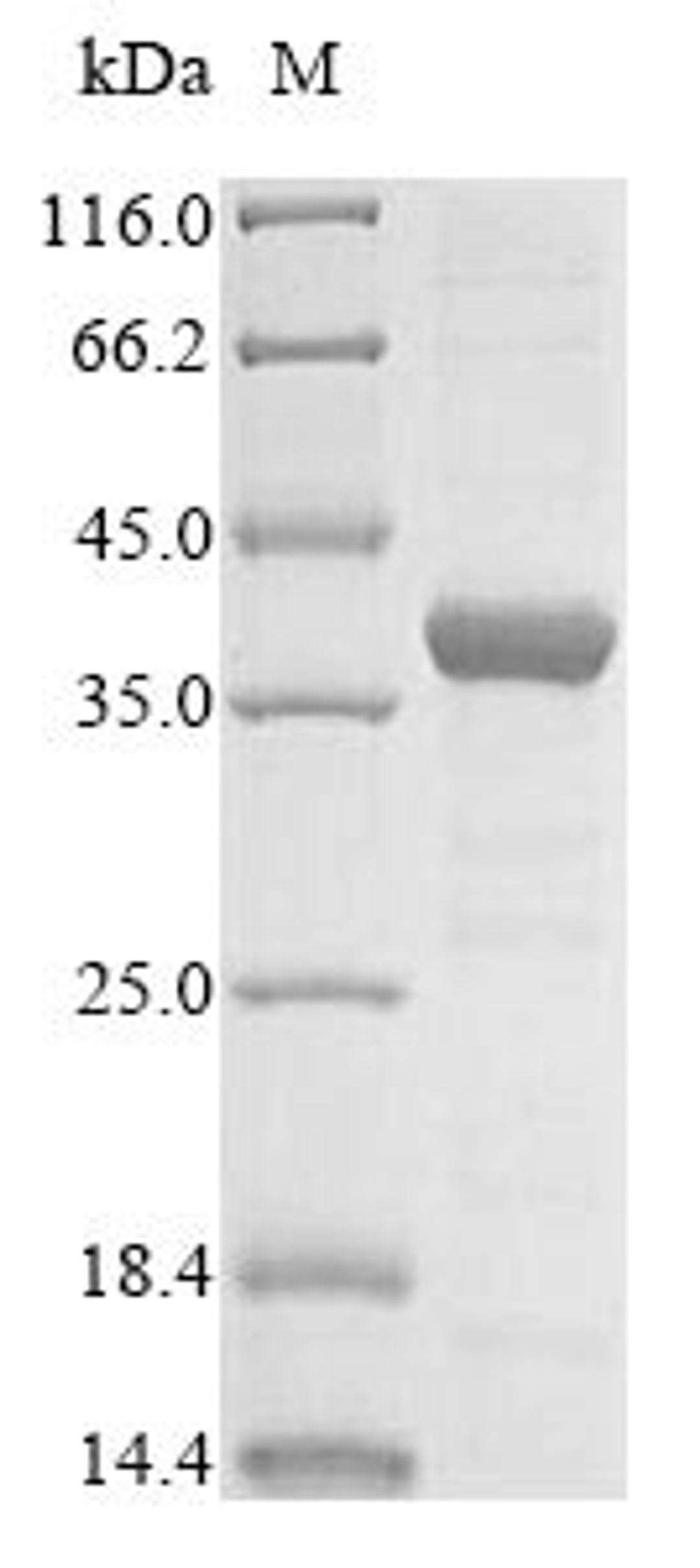 (Tris-Glycine gel) Discontinuous SDS-PAGE (reduced) with 5% enrichment gel and 15% separation gel.