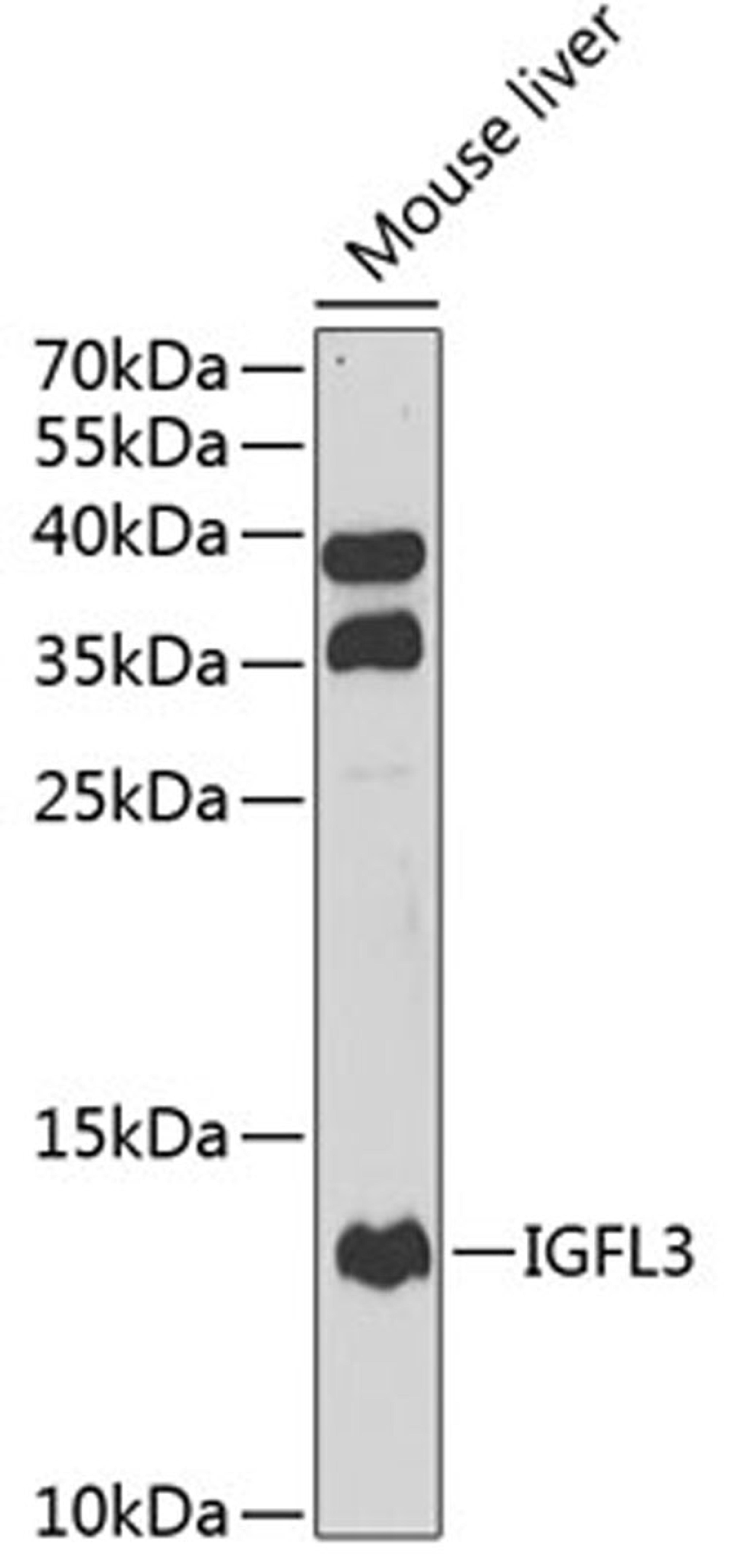 Western blot - IGFL3 antibody (A7154)