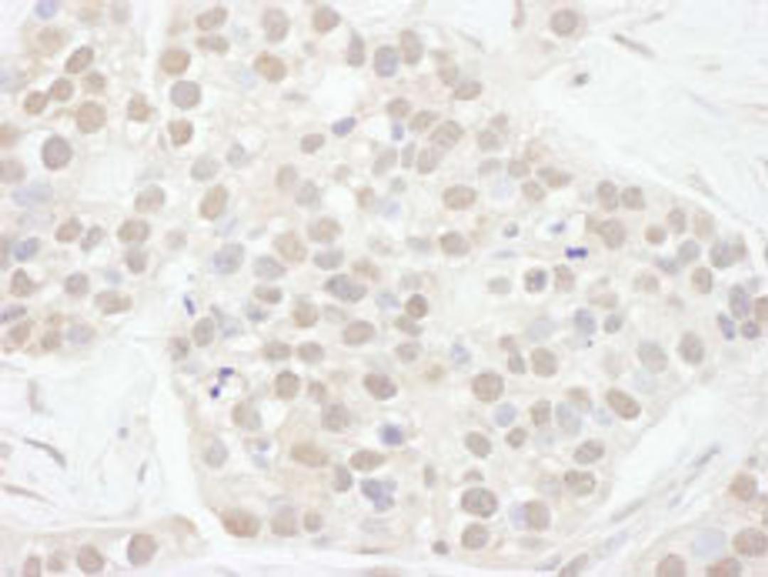 Detection of human Cyclin T1 by immunohistochemistry.