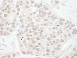 Detection of human Cyclin T1 by immunohistochemistry.