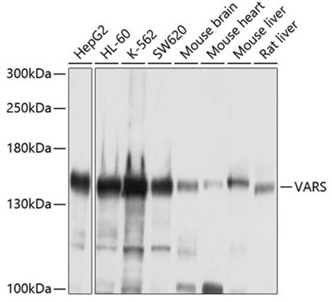 Western blot - VARS antibody (A4182)