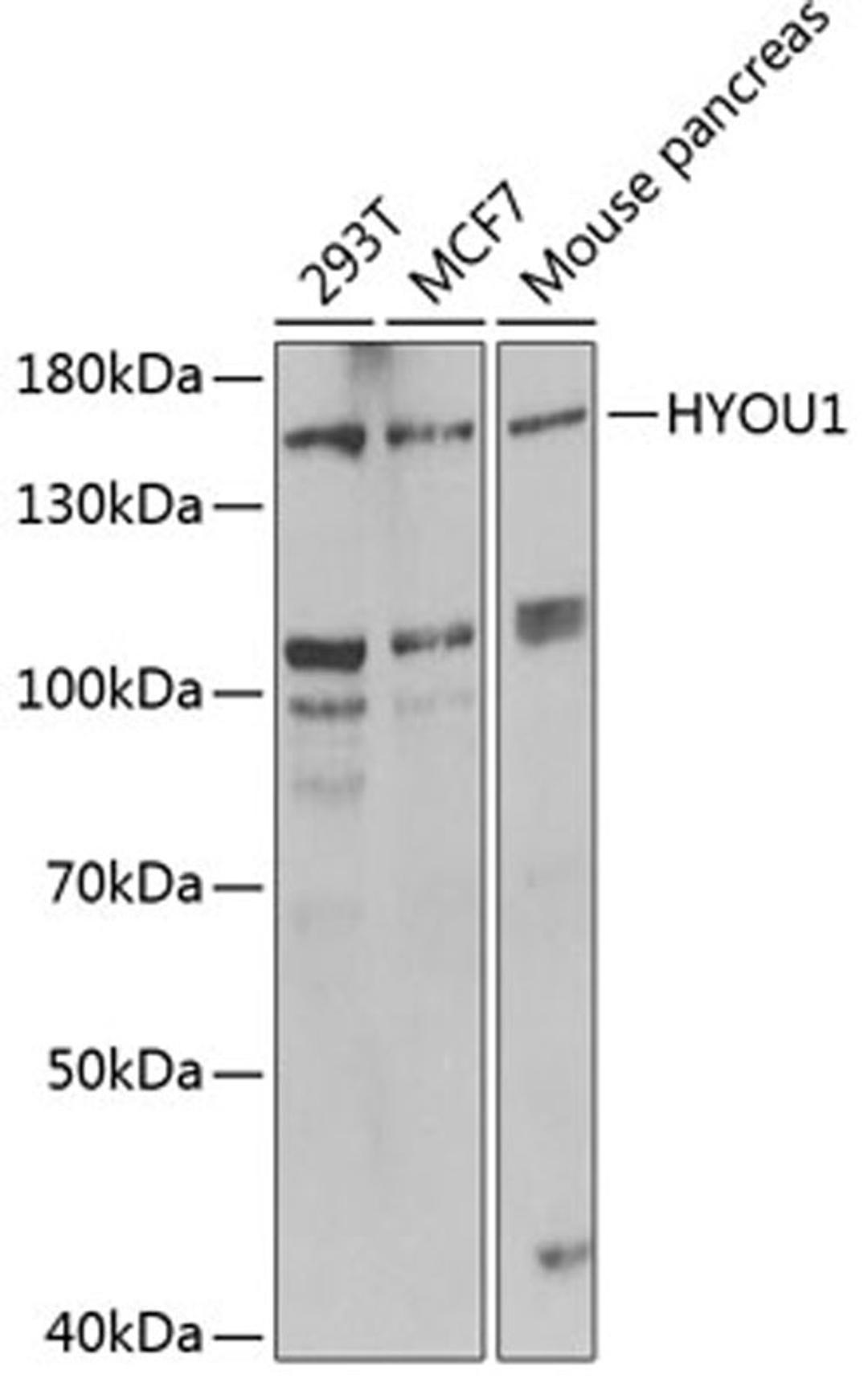 Western blot - HYOU1 antibody (A6625)