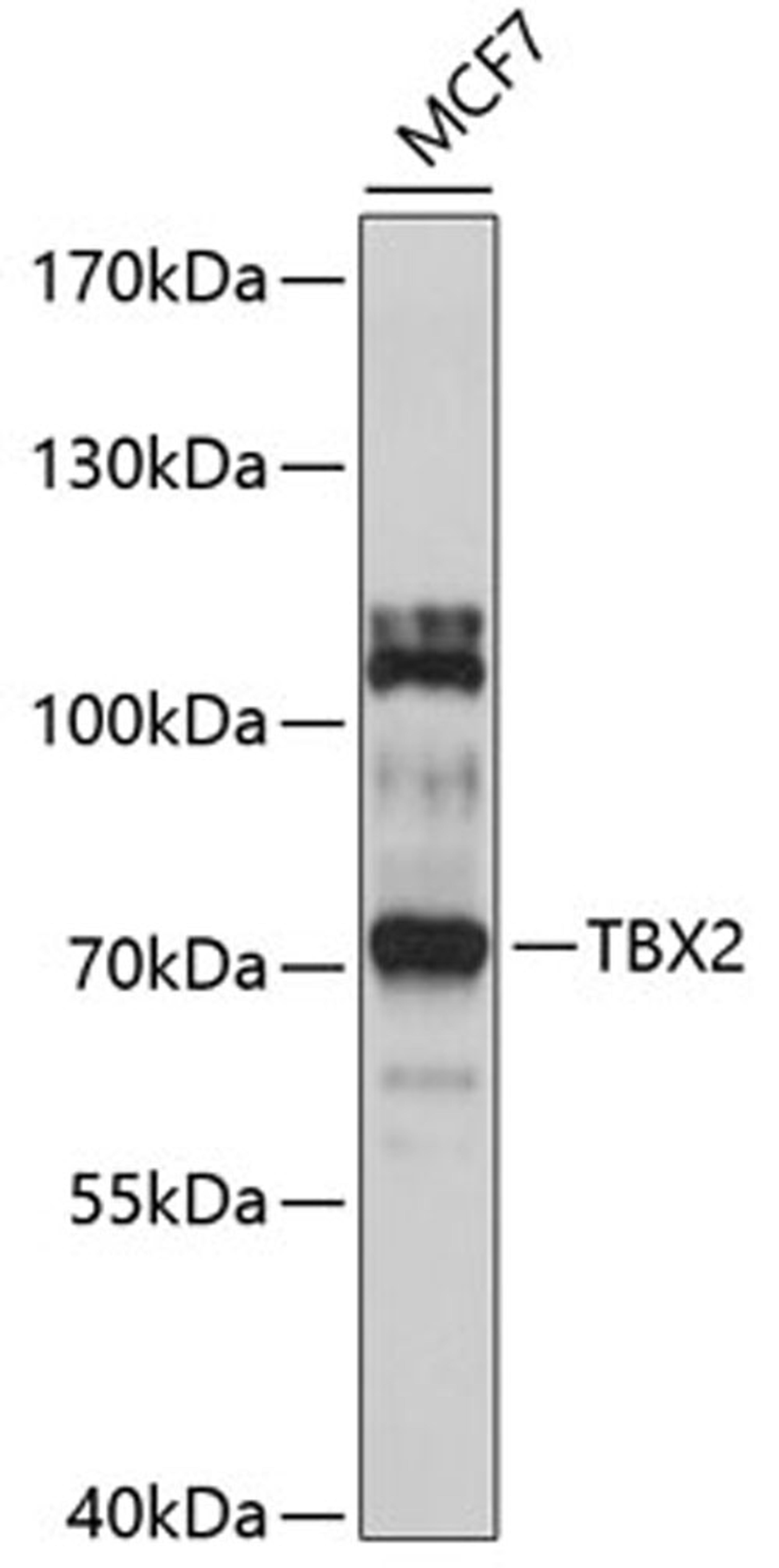 Western blot - TBX2 antibody (A10250)