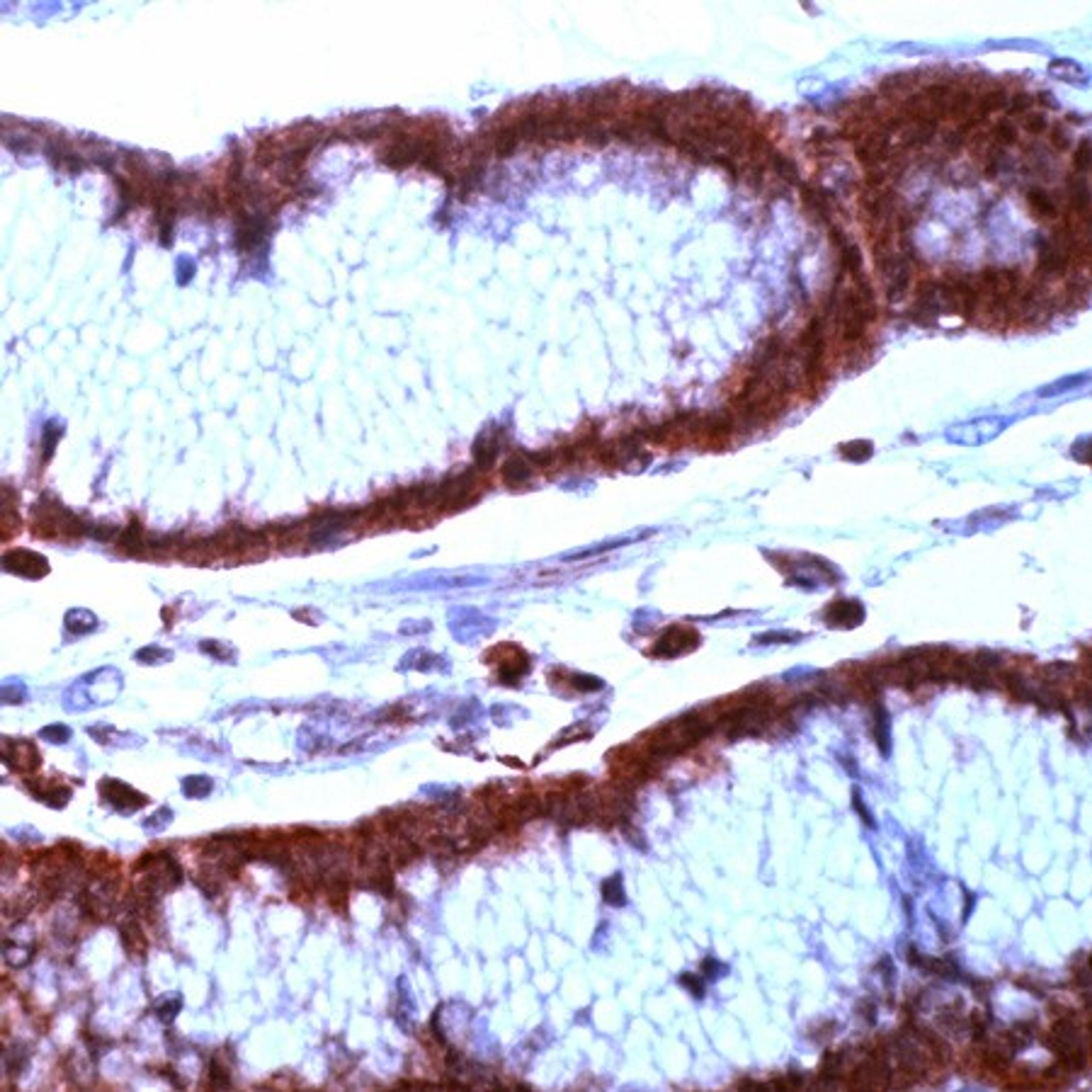 Immunohistochemistry staining of BIRC5 in human stomach tissue using BIRC5 Antibody.