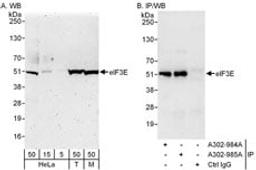 Detection of human and mouse eIF3E by western blot (h&m) and immunoprecipitation (h).