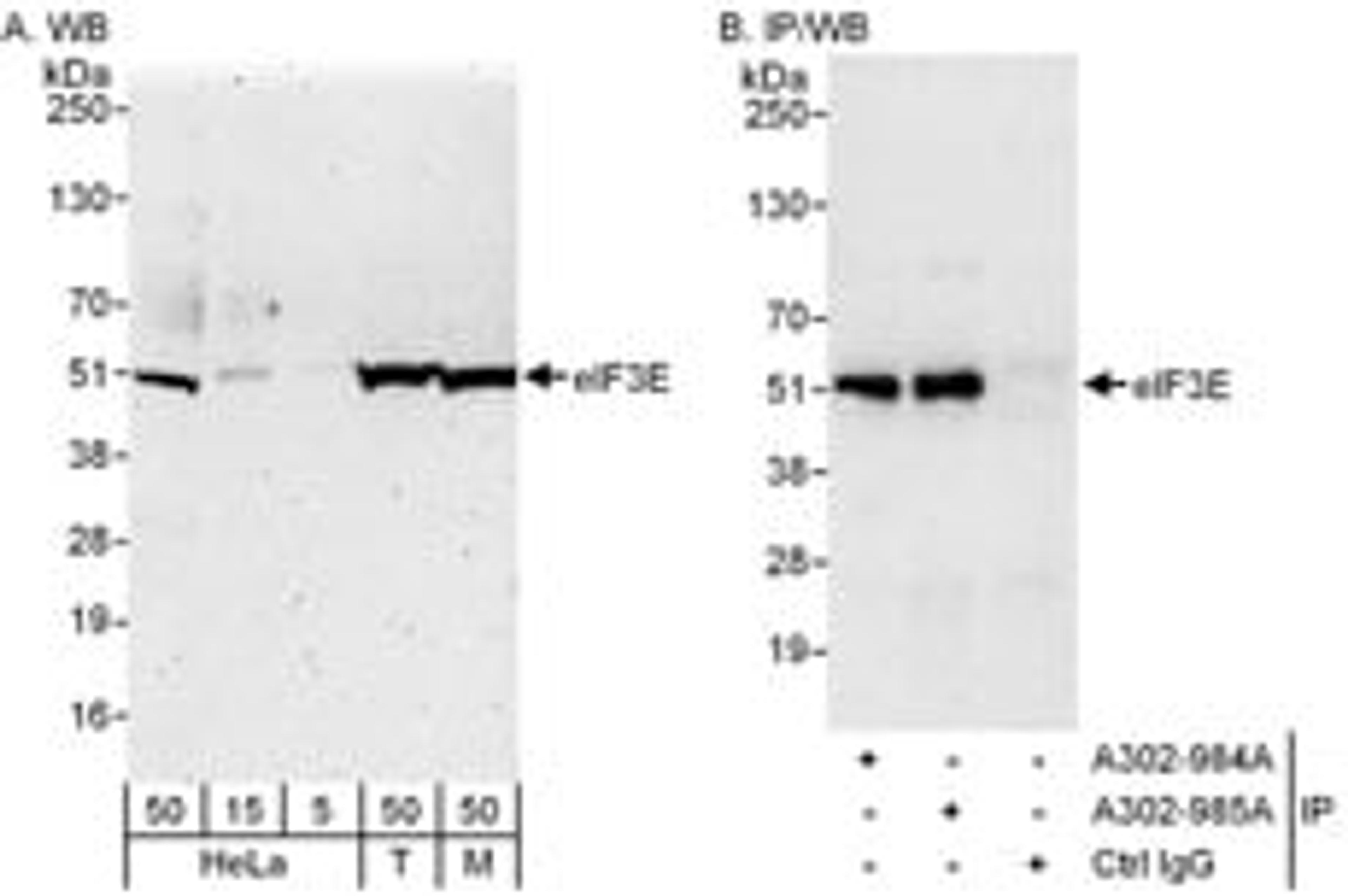 Detection of human and mouse eIF3E by western blot (h&m) and immunoprecipitation (h).