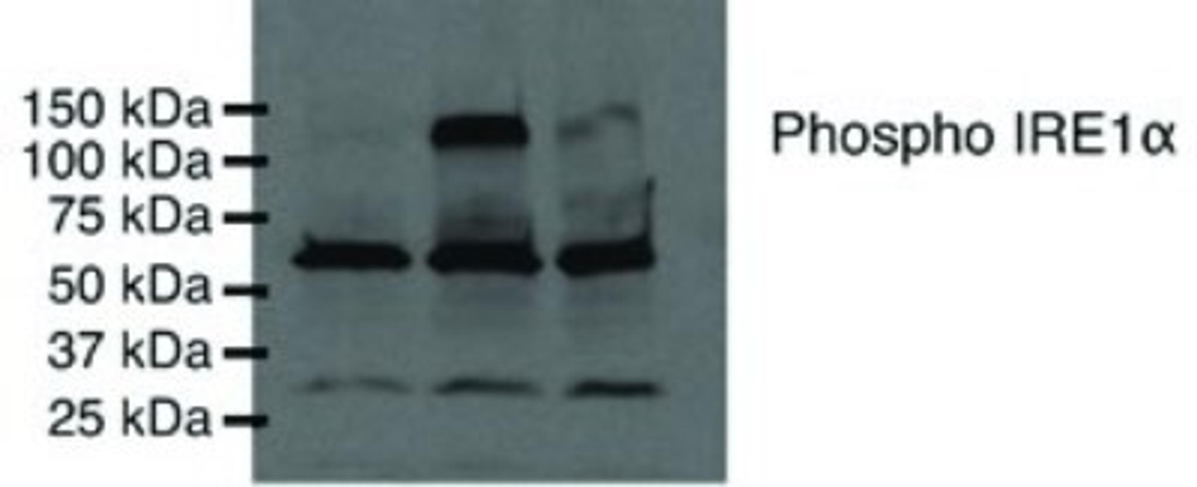 Western Blot: IRE1 alpha [p Ser724] Antibody [NB100-2323] - Analysis using the HRP conjugate of NB100-2323. Detection of phosphorylated IRE-1 alpha using NB100-2323. Lane 1: COS-7 untransfected Lane 2: COS-7 expressing wild-type IRE1 alpha Lane 3: COS-7 expressing kinase-dead IRE1 alpha.