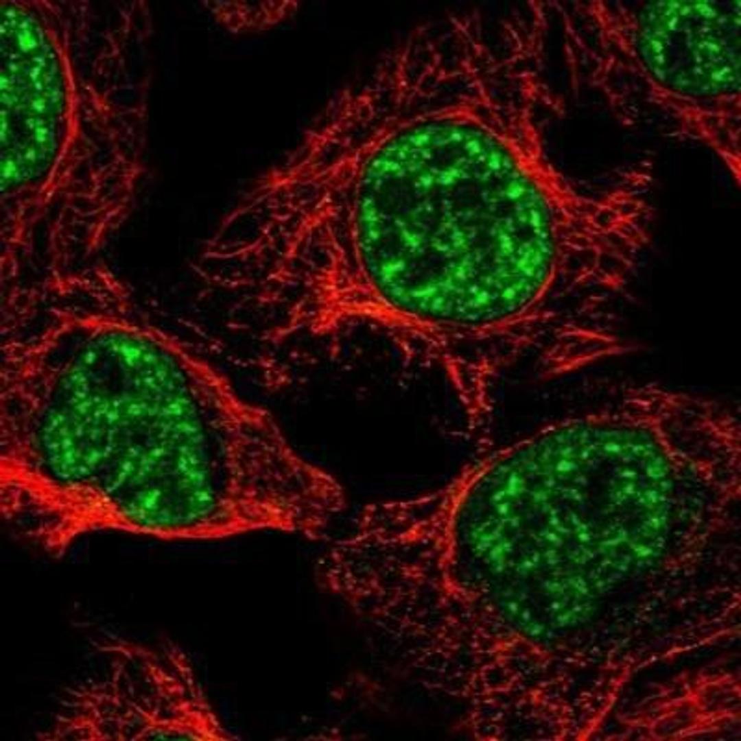 Immunocytochemistry/ Immunofluorescence: PRPF4B Antibody [NBP1-82999] -  Staining of human cell line A-431 shows positivity in nuclei but not nucleoli.