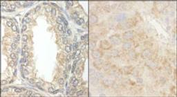 Detection of human and mouse BAD by immunohistochemistry.