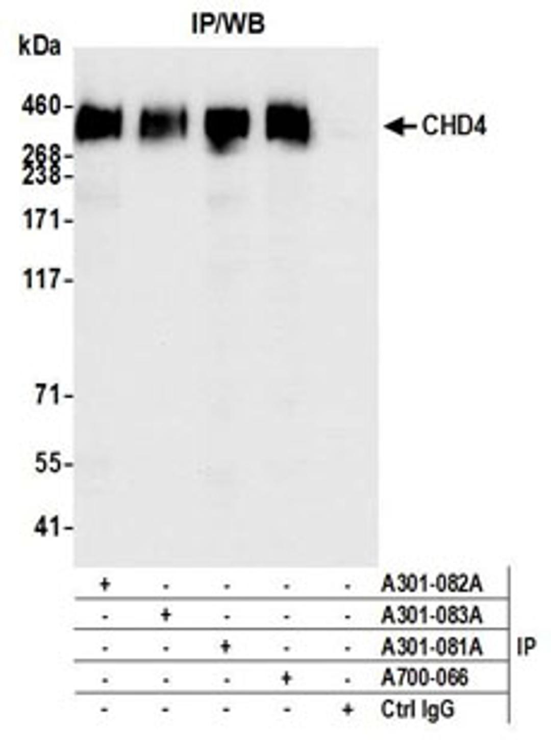 Detection of human CHD4 by western blot of immunoprecipitates.