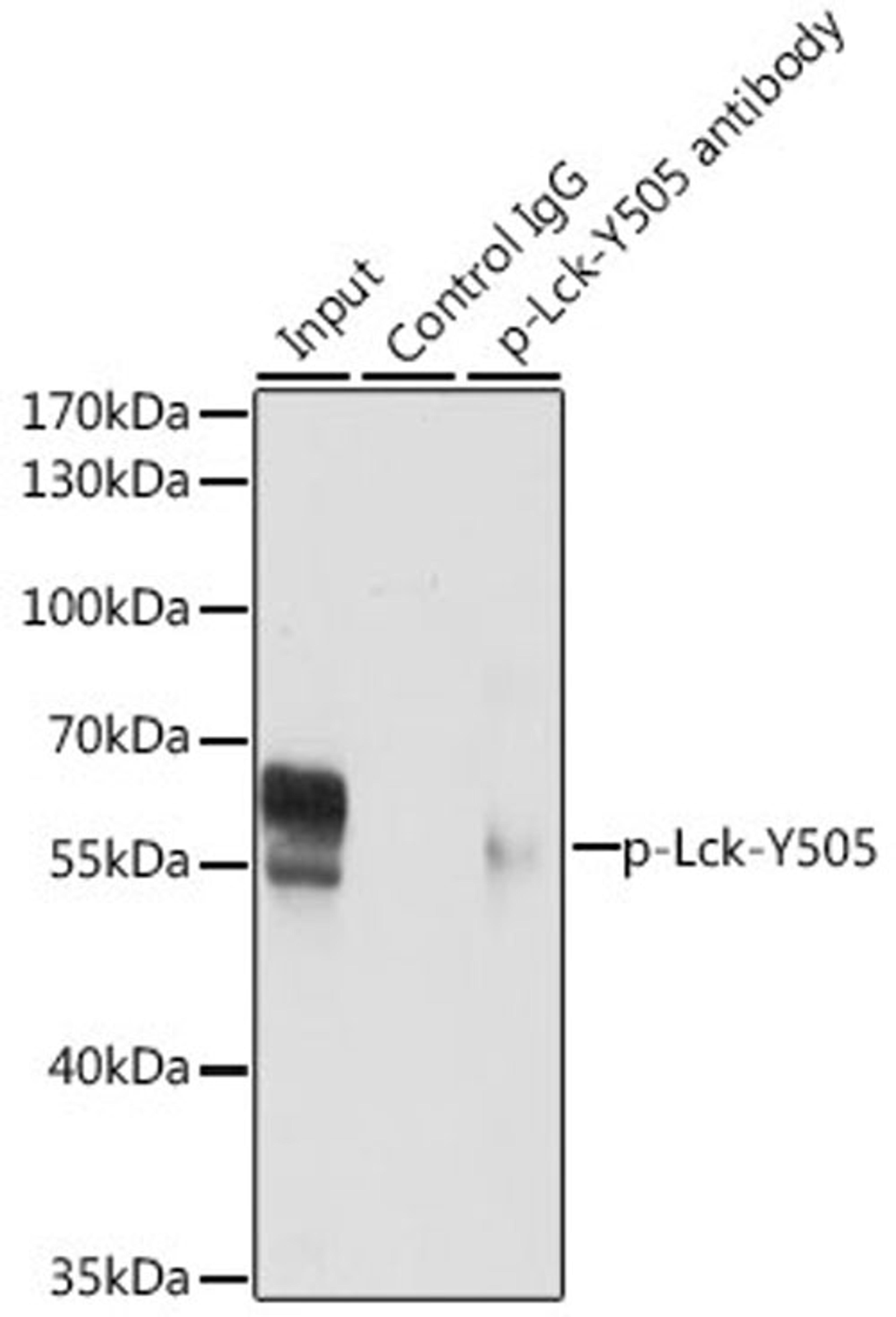 Immunoprecipitation - 3 ug Phospho-Lck-Y505 pAb (AP0285)