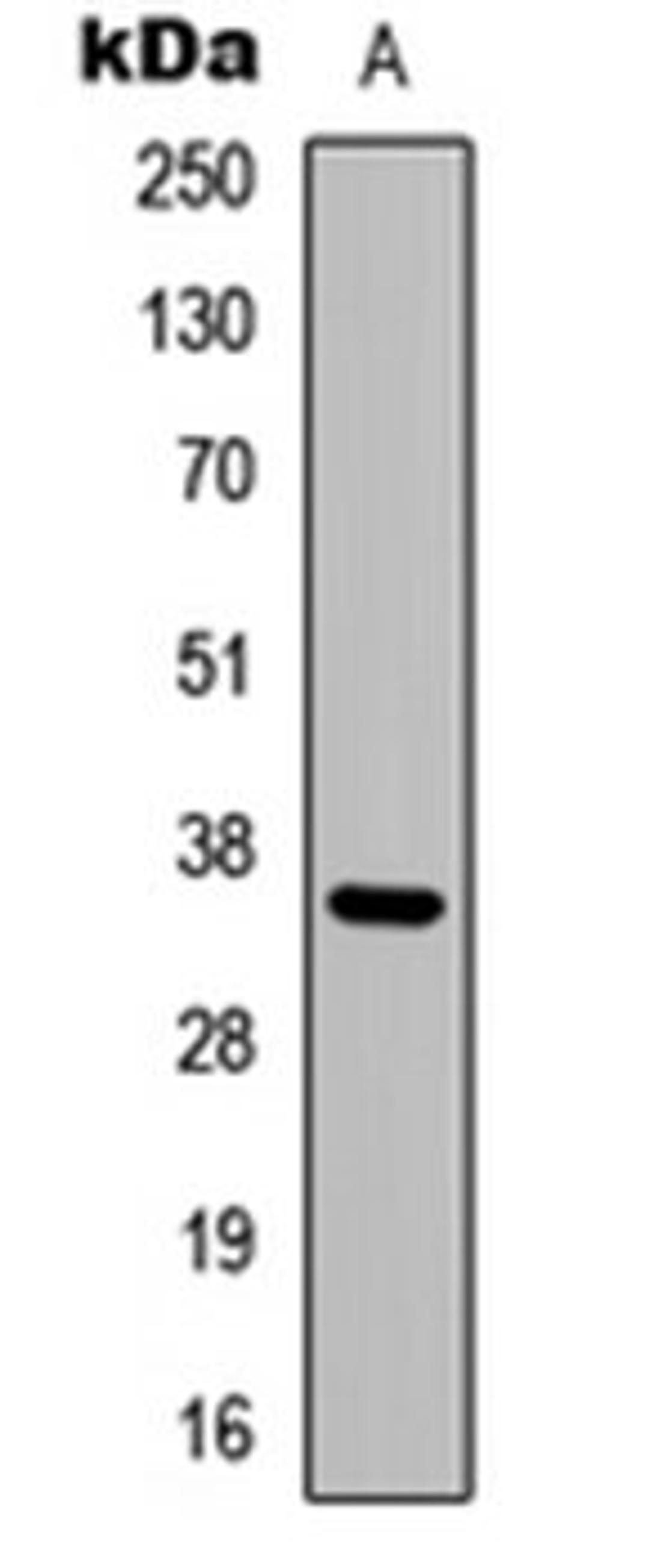 Western blot analysis of MCF7 (Lane 1) whole cell lysates using Adenosine A3 Receptor antibody