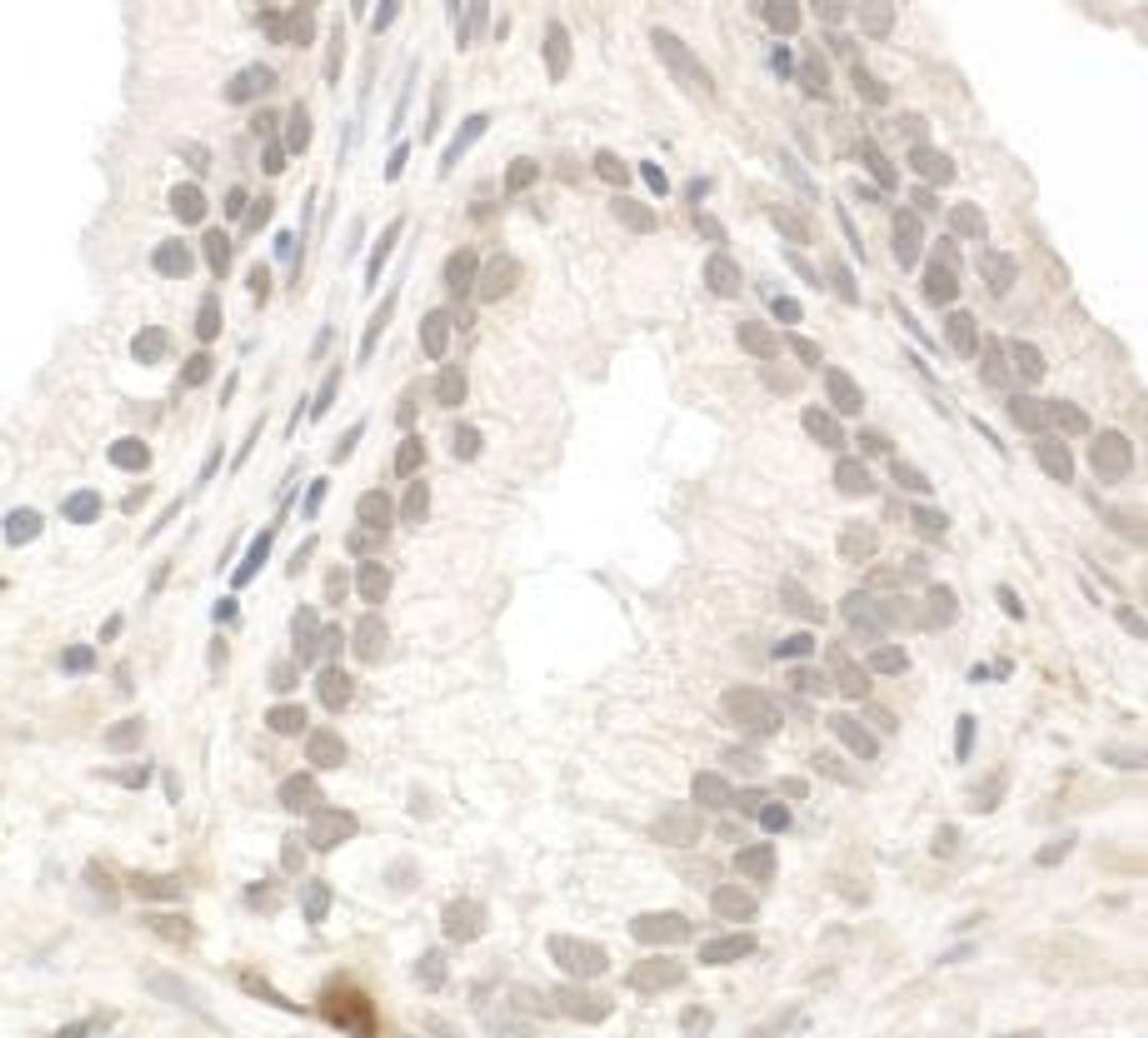 Detection of human PIMT by immunohistochemistry.