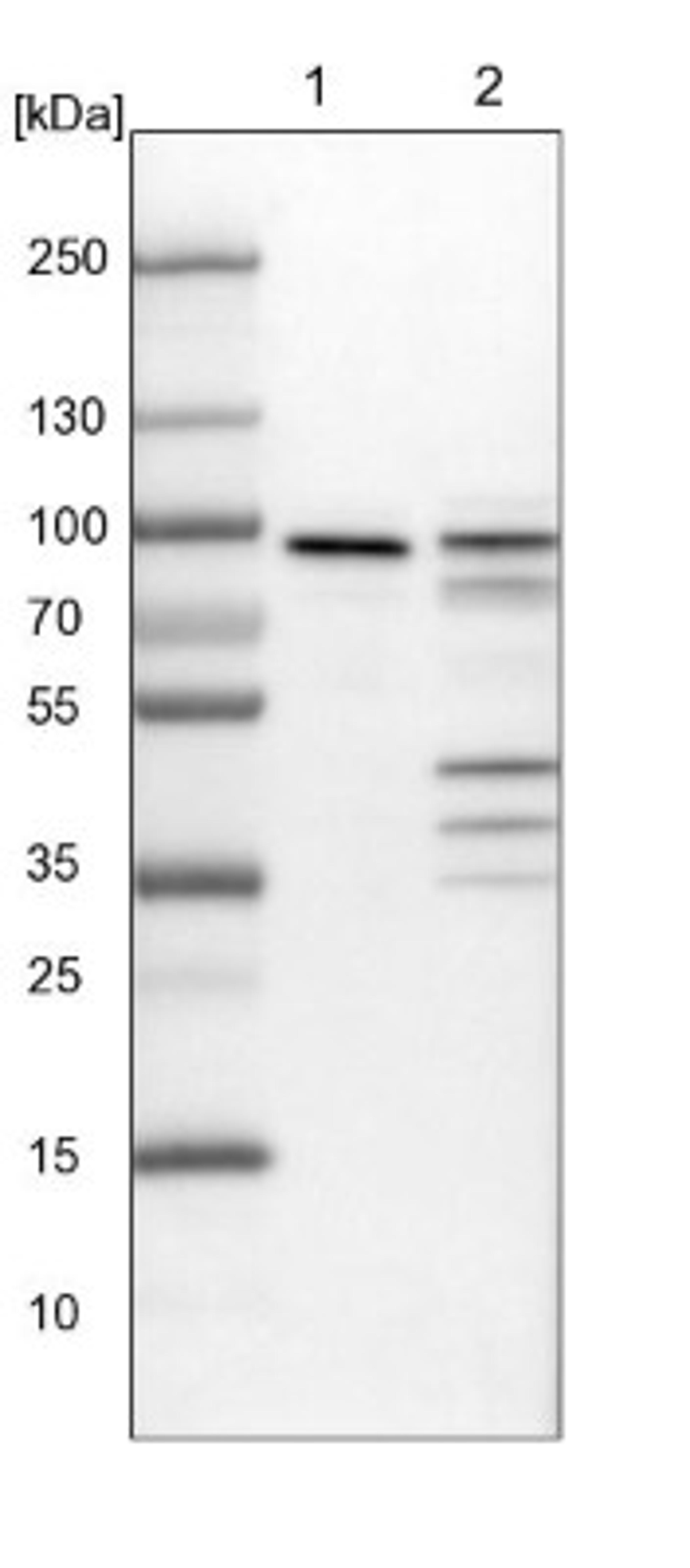 Western Blot: Mena Antibody [NBP1-87914] - Lane 1: NIH-3T3 cell lysate (Mouse embryonic fibroblast cells)<br/>Lane 2: NBT-II cell lysate (Rat Wistar bladder tumour cells)